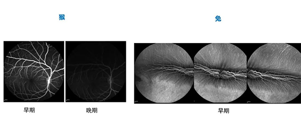 不同时期的眼底荧光造影（FA）.jpg